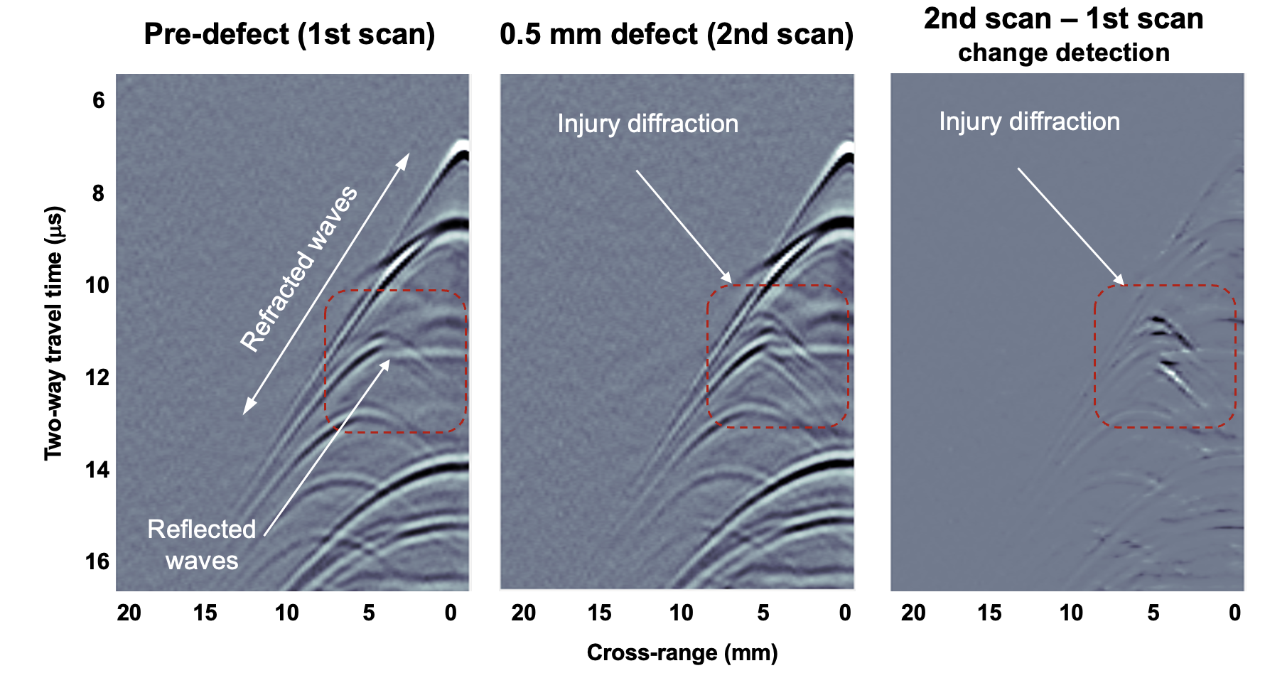 Before-and-after Noncontact Laser Ultrasound images of a bone/tissue phantom show a 0.5 mm defect on the bone surface.