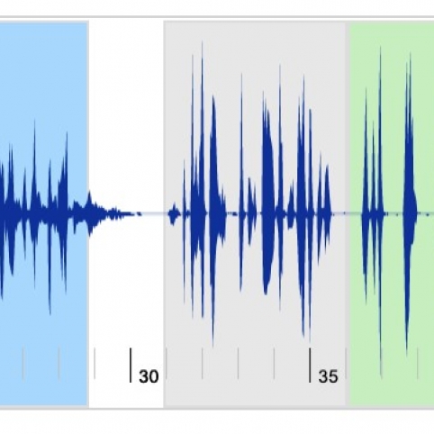 Audio waveforms