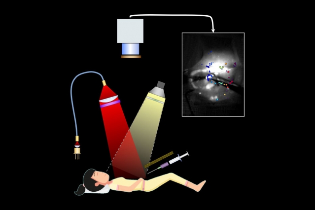 an illustration of a patient being injected with a flueurescent solitution and camera overhead that images the patient's tissue 