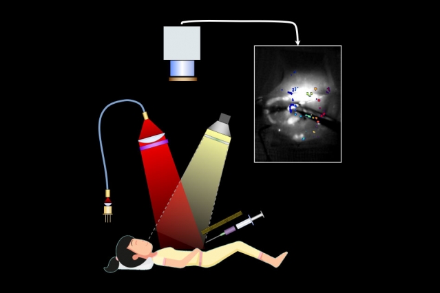 an illustration of a patient being injected with a flueurescent solitution and camera overhead that images the patient's tissue