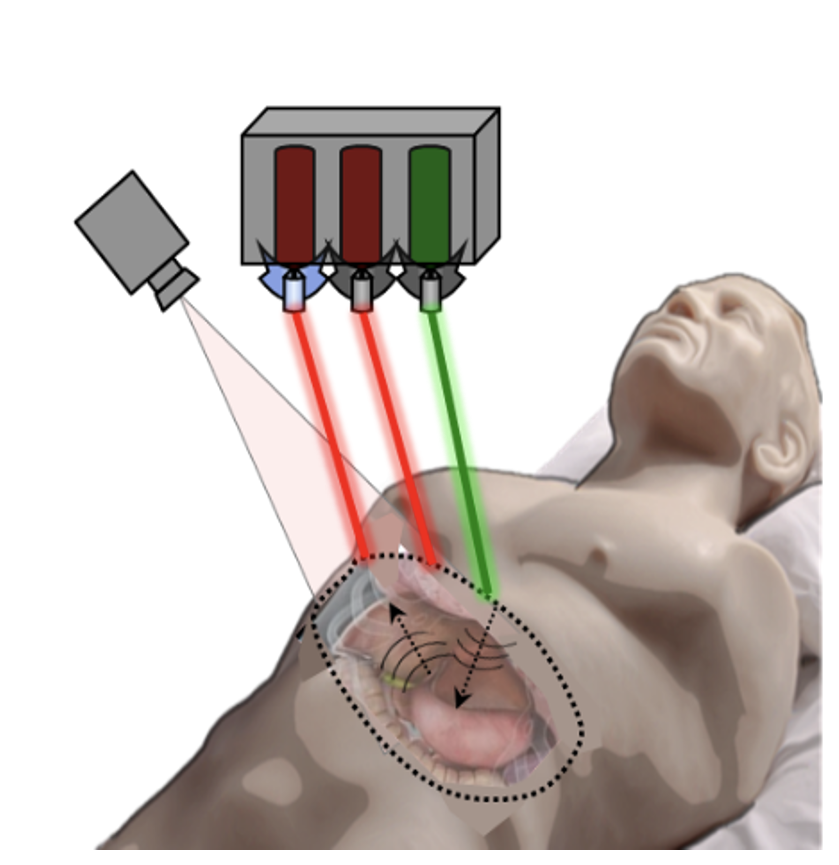 A schematic of a human body dummy showing pulsed laser light in green going into the body to image the interior, a laser receiver with two receive channels in red, and a camera recording laser beam positions used for image construction.