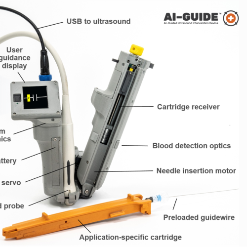 This illustration shows the AI-GUIDE device, including its UI display and handheld ultrasound component.