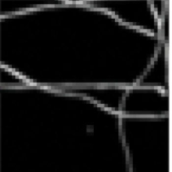 Image showing a centerline tracing