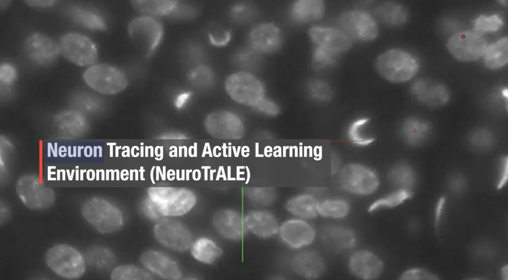 This is a demo video of how NeuroTrALE works. Various user unctions are described and demonstrated.