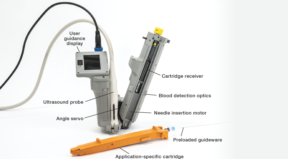 ultrasound machine diagram