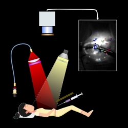 an illustration of a patient being injected with a flueurescent solitution and camera overhead that images the patient's tissue 