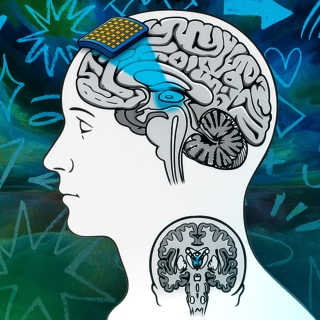 Transcranial focused ultrasound, a noninvasive brain imaging tool depicted in the illustration, may help researchers gain knowledge about human consciousness.