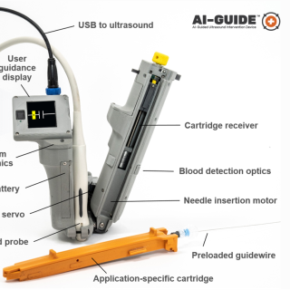 This illustration shows the AI-GUIDE device, including its UI display and handheld ultrasound component.
