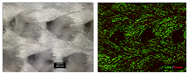 A close-up of an interlock knit without cells and a knit seeded with growing mesenchymal stem cells from a mouse. Green and red spots indicate live and dead cells, respectively, with a significantly greater number of green showing. 