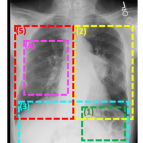 A color-coded annotated x-ray that corresponds to text describing what is shown inside different portions of the x-ray image. Text not shown in this image.